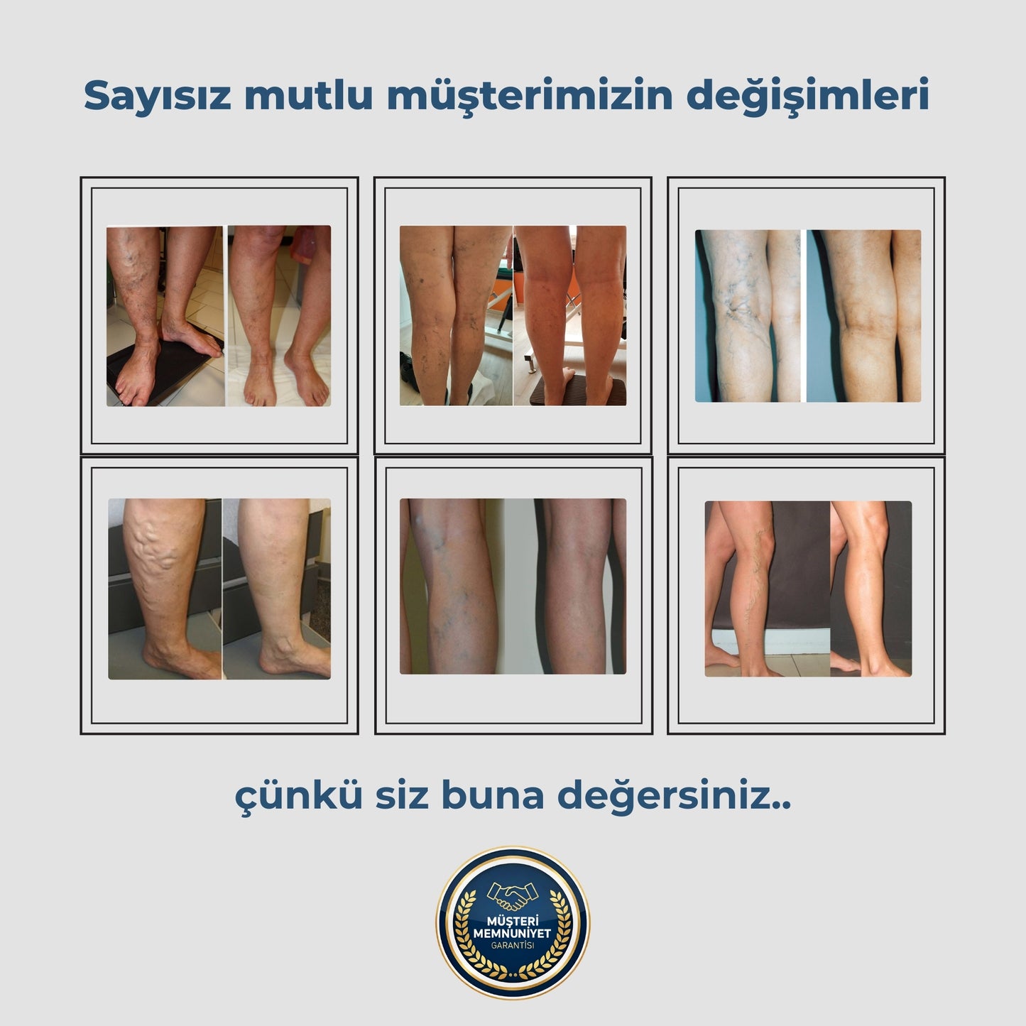 Feedenze 3'lü Etki Varis Çorabı