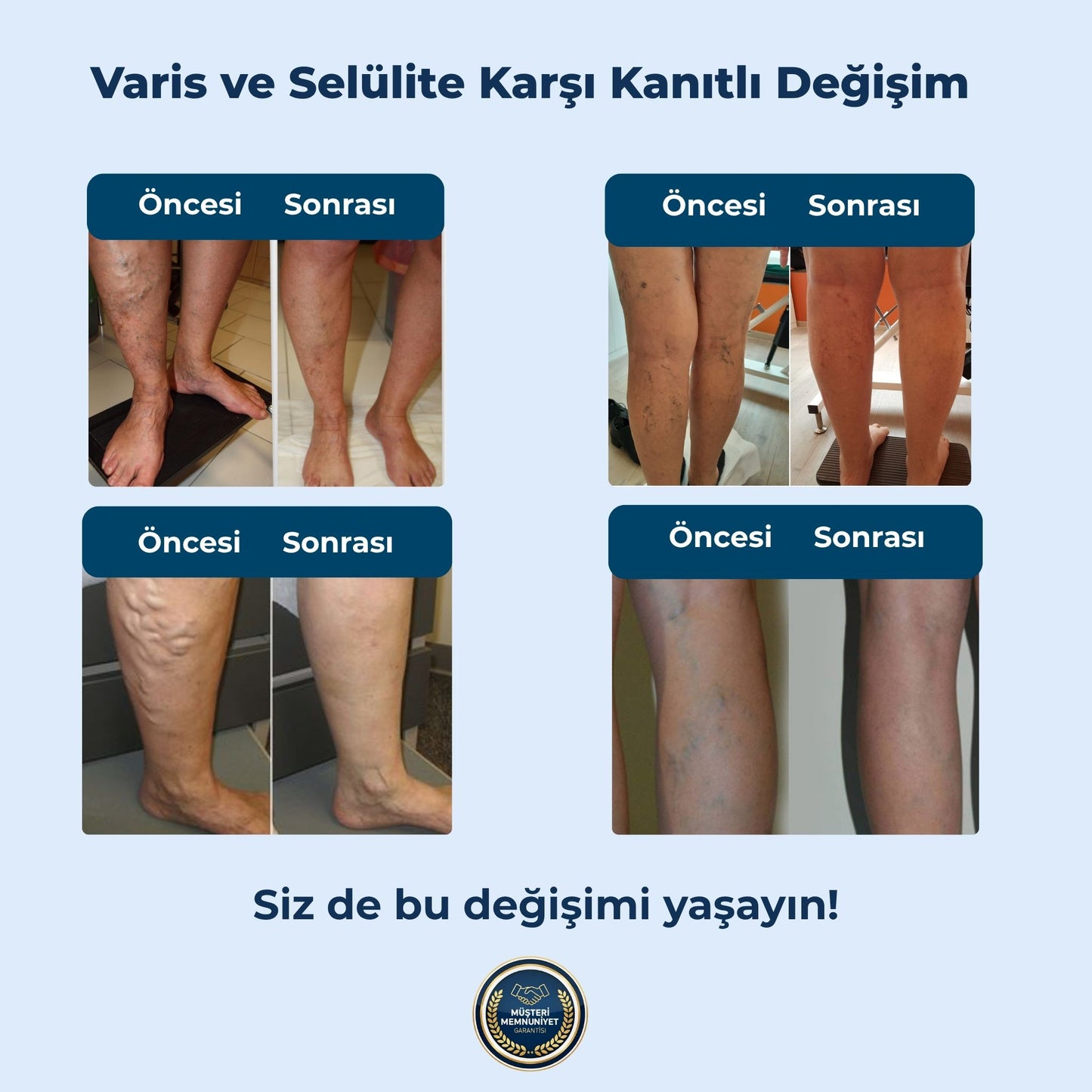 Feedenze 3'lü Etki Varis Çorabı