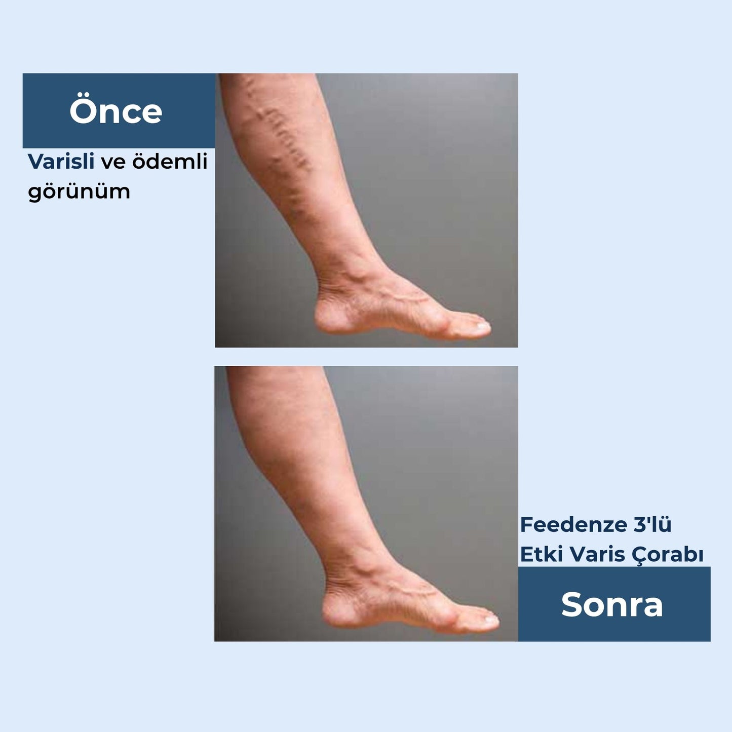 Feedenze 3'lü Etki Varis Çorabı